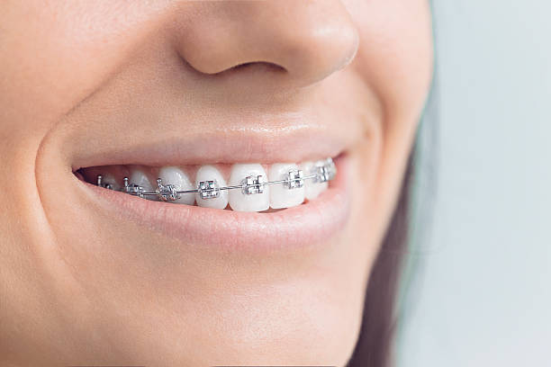 Best Traditional Braces  in Bethesda, MD